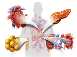 A vector of a human body with different organs highlighted that are affected by MetS 