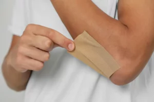 Understanding the factors that influence wound healing is crucial for optimal patient care. 