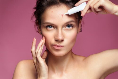 Scowling girl pointing at her acne and applying treatment cream. Photo of young girl with problem skin on pink background. Skin care concept.