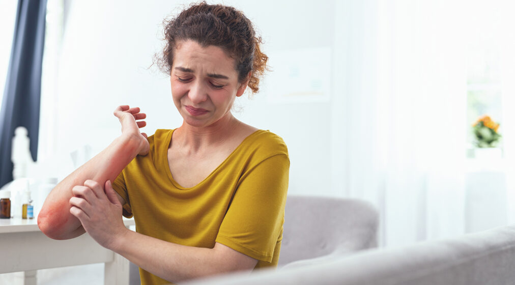 Disgusting rash. Young girl feeling helpless to resist the itchiness caused by the rash on her elbow and wrist