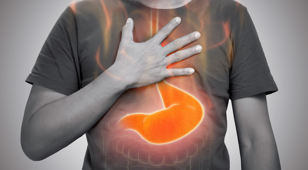 Photograph of a man holding his chest, experiencing gastric reflux