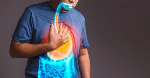 gastroesophageal reflux disease : GERD.