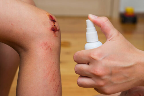 Woman sprays an antiseptic agent on the wound on the child’s knee. Treatment the wound. First Aid.